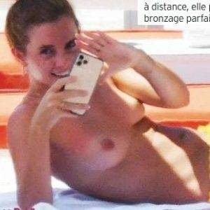 Delphine EMMA WATSON TOPLESS NUDE SUNBATHING PHOTOS PUBLISHED IN FRANCE - France on shefanatics.com